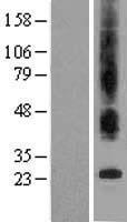 Bax inhibitor 1 (TMBIM6) Human Over-expression Lysate