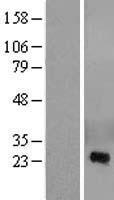 CRISP2 Human Over-expression Lysate