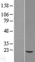 UBE2G1 Human Over-expression Lysate