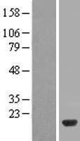 UBE2D2 Human Over-expression Lysate