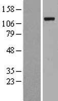 UBA1 Human Over-expression Lysate