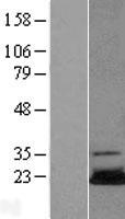 UBE2N Human Over-expression Lysate