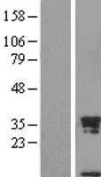Uteroglobin (SCGB1A1) Human Over-expression Lysate