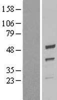 UQCRC2 Human Over-expression Lysate