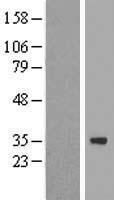 ZNF124 Human Over-expression Lysate