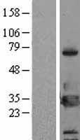 14 3 3 eta (YWHAH) Human Over-expression Lysate