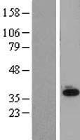 SLC25A11 Human Over-expression Lysate