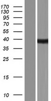 SPT3 (SUPT3H) Human Over-expression Lysate