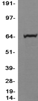 PPM1D Human Over-expression Lysate