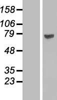 FATP2 (SLC27A2) Human Over-expression Lysate