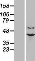PRP18 homolog (PRPF18) Human Over-expression Lysate