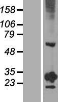 RGS20 Human Over-expression Lysate
