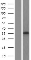 Retinol dehydrogenase 16 (RDH16) Human Over-expression Lysate