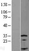 SSNA1 Human Over-expression Lysate