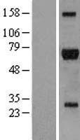 RIP2 (RIPK2) Human Over-expression Lysate