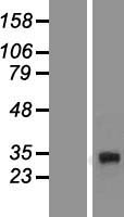 DcR3 (TNFRSF6B) Human Over-expression Lysate