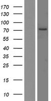 RGS9 Human Over-expression Lysate