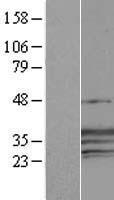 CREG1 Human Over-expression Lysate