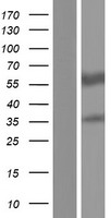 ALDH1A2 Human Over-expression Lysate