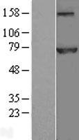 Apc6 (CDC16) Human Over-expression Lysate