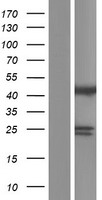 ST13 Human Over-expression Lysate
