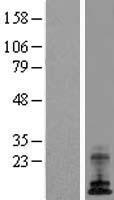 ATP6V0E1 Human Over-expression Lysate