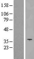 SLC25A14 Human Over-expression Lysate
