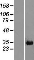 CH25H Human Over-expression Lysate