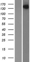 JLP (SPAG9) Human Over-expression Lysate