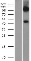SLC7A6 Human Over-expression Lysate