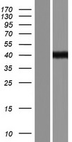 Dystrophin (DMD) Human Over-expression Lysate