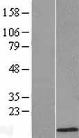 ATOX1 Human Over-expression Lysate