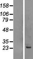 CAPS Human Over-expression Lysate