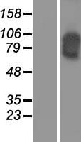 Cadherin 16 (CDH16) Human Over-expression Lysate