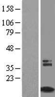TIMM8A Human Over-expression Lysate
