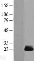 CSRP1 Human Over-expression Lysate