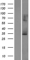 ECHS1 Human Over-expression Lysate