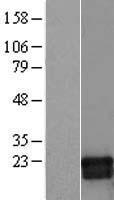 GMF beta (GMFB) Human Over-expression Lysate