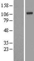 IREB2 Human Over-expression Lysate