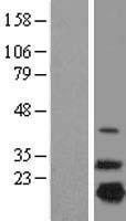 NDUFB7 Human Over-expression Lysate