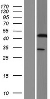 KRT33A Human Over-expression Lysate