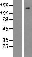 SREBP1 (SREBF1) Human Over-expression Lysate