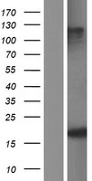 SNRPD3 Human Over-expression Lysate