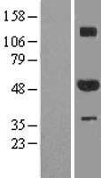 ZNF213 Human Over-expression Lysate