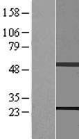 Rab11 (RAB11B) Human Over-expression Lysate