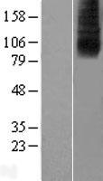 SLC28A2 Human Over-expression Lysate