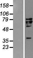 AIF (AIFM1) Human Over-expression Lysate