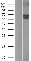 BMPR1A Human Over-expression Lysate