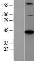 BCS1L Human Over-expression Lysate