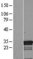 CRSP9 (MED7) Human Over-expression Lysate